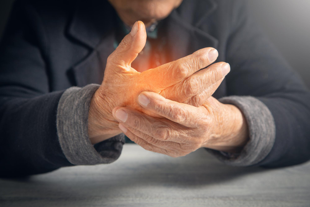 Arthritis